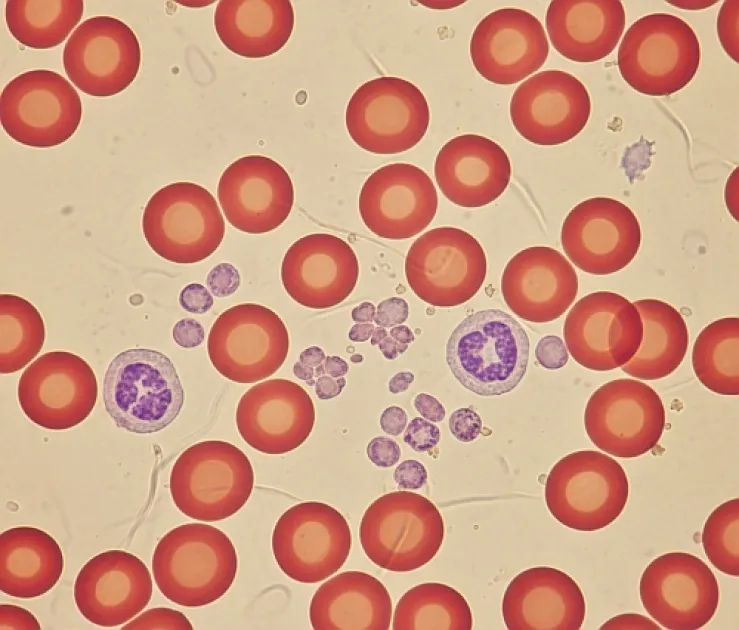 Dunkelfeldmikroskopie Lebendige Einblicke in das Blut und ihre Anwendungen Methode