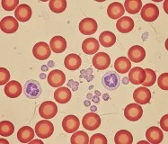 Was ist Dunkelfeldmikroskopie?