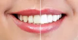 Zahnheilkunde Methode