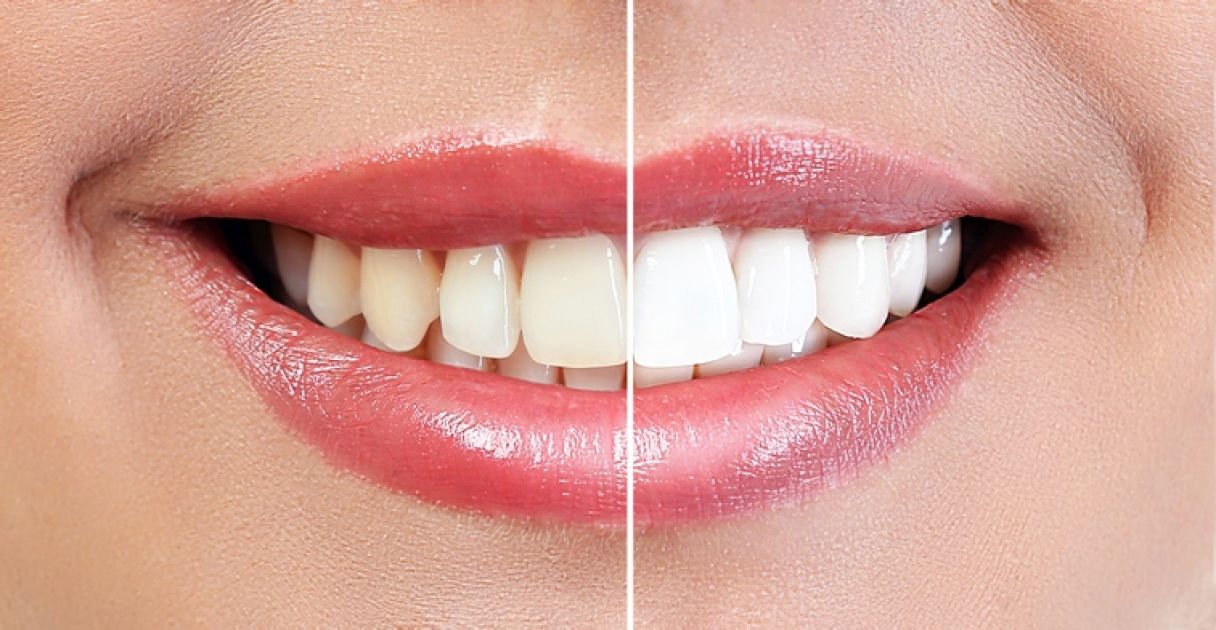 Zahnheilkunde Methode